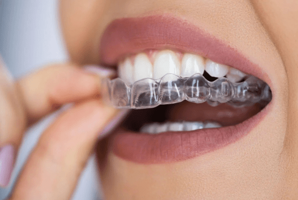 Invisalign Sopron
